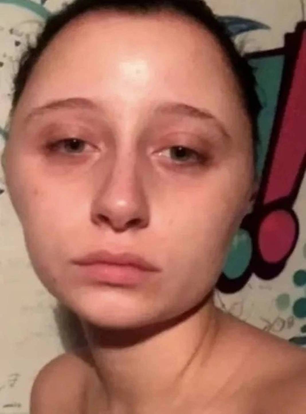 Marketten aldığı ürünle saçını boyadı: Kafası ampul gibi şişti! Yakınları bile tanıyamadı 15